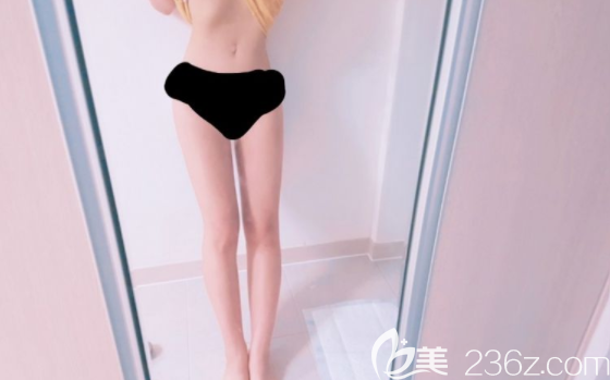 吸脂后一個(gè)月 吸脂后一個(gè)月