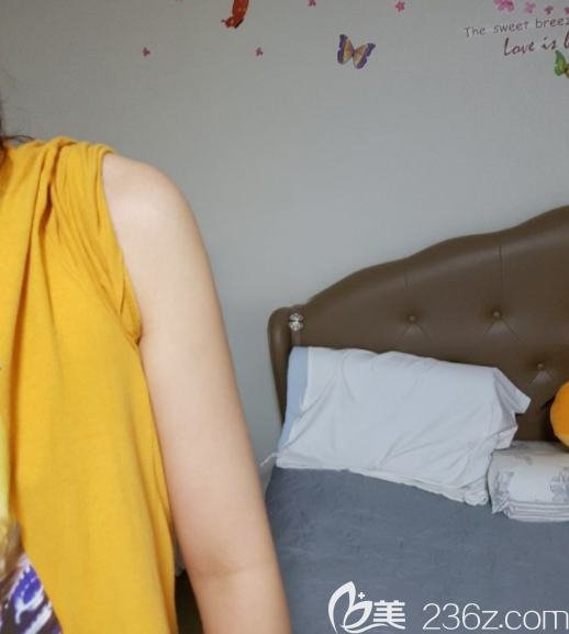 吸脂一個(gè)月 吸脂一個(gè)月