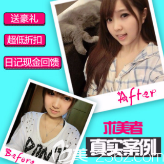 濟(jì)南歷下寶琳娜自體脂肪填充面部案例