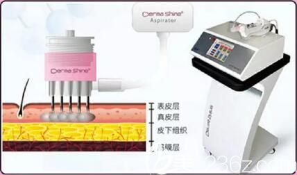 百嘉麗超能美白的優(yōu)勢(shì)