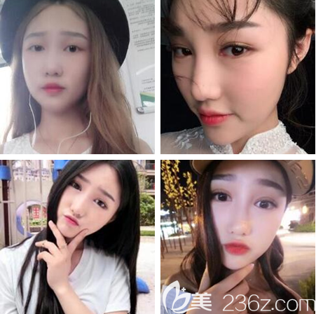 貴陽(yáng)哪個(gè)醫(yī)生割雙眼皮好 貴陽(yáng)哪個(gè)醫(yī)生割雙眼皮好