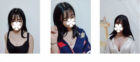 孫振東假體隆胸術(shù)后28天恢復(fù)效果