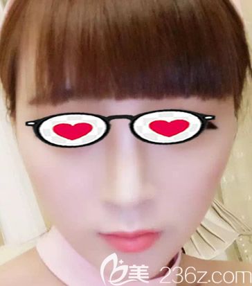 正規(guī)瘦臉多少錢一次 我在呼和浩特大韓整形打瘦臉后的感受和價(jià)格分享給大家