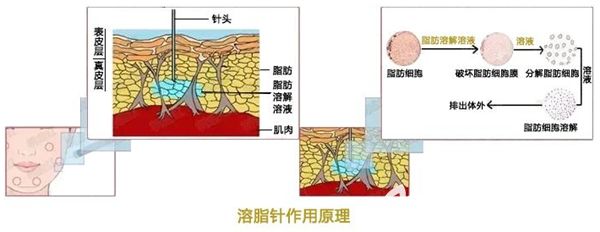 韓國(guó)維摩原理