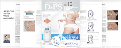 韓國(guó)verni整形醫(yī)院李慶洛發(fā)表部分論文 韓國(guó)verni整形醫(yī)院李慶洛發(fā)表部分論文