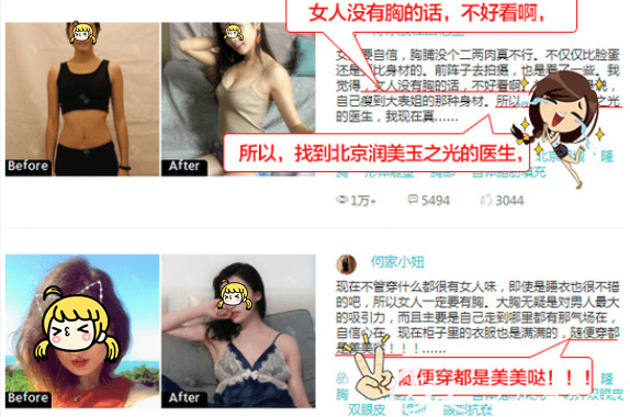 愛美者找北京潤美玉之光王明利醫(yī)生隆胸后的部分體驗(yàn)展示