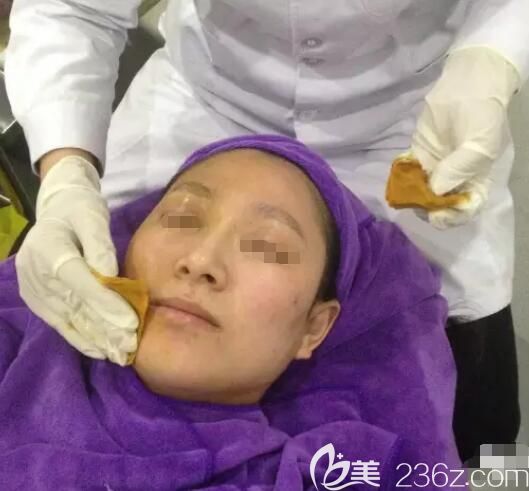 敷麻藥之后還要對(duì)面部進(jìn)行消毒處理