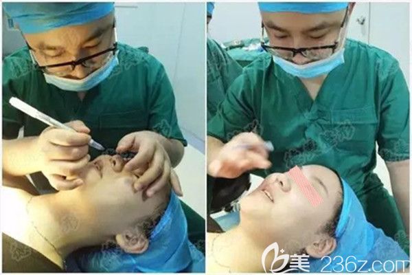 符主任做鼻綜合術(shù)前設(shè)計 符主任做鼻綜合術(shù)前設(shè)計