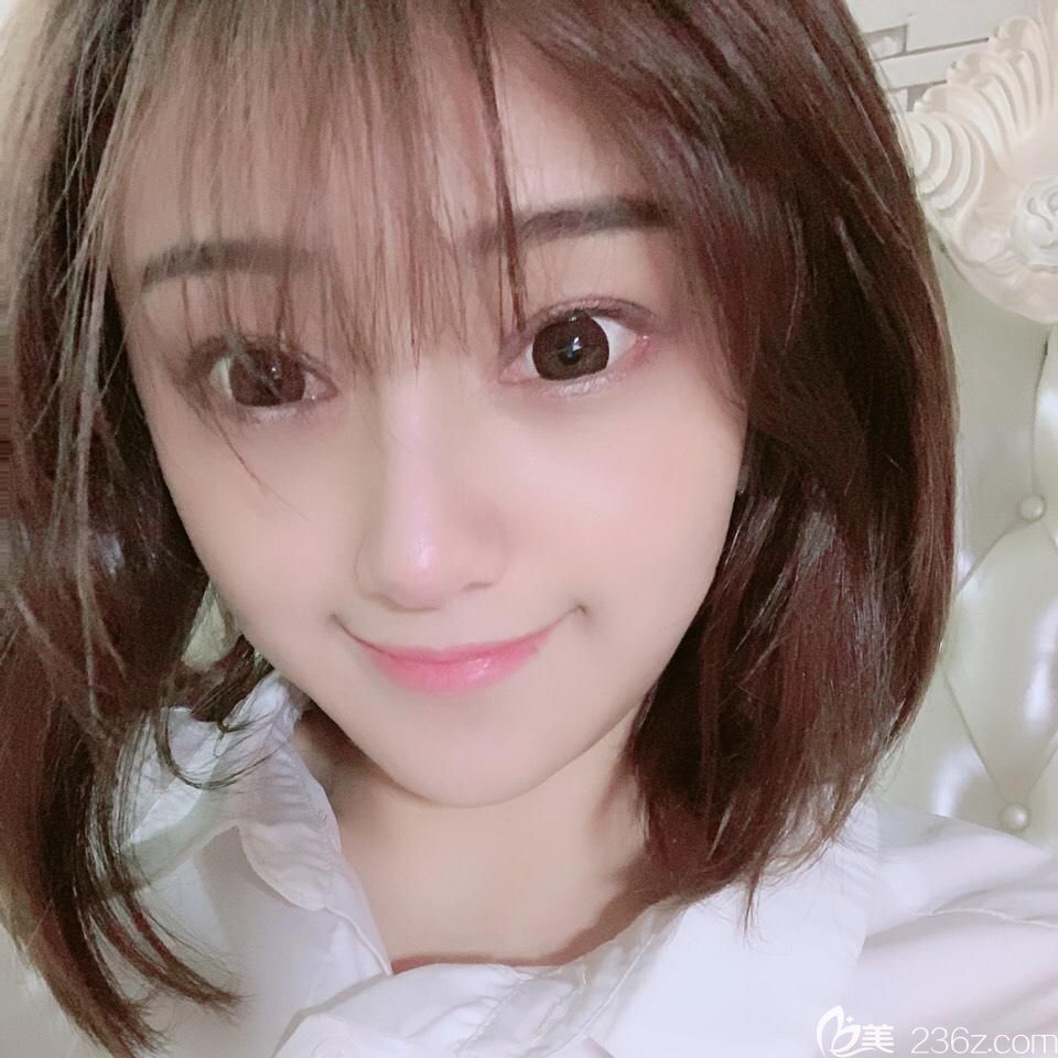  今天我是找胡準做埋線雙眼皮失敗修復+鼻綜合42天，不后悔選擇了合肥白領安琪兒做手術