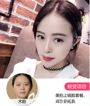 貴陽(yáng)美萊案例