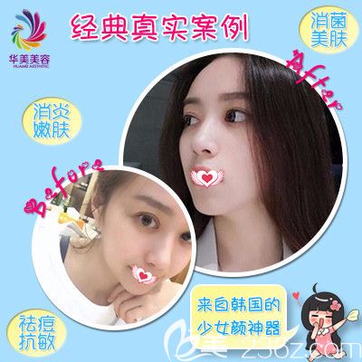 邯鄲華美微針美塑案例