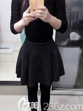 找南寧韓星整形院長做腰腹部360度水動力環(huán)形吸脂1個月?lián)碛行⌒U腰，分享我的親身經(jīng)歷