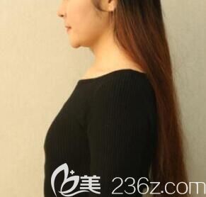 我在南寧東方整形醫(yī)院做吸脂和豐胸前的照片 我在南寧東方整形醫(yī)院做吸脂和豐胸前的照片