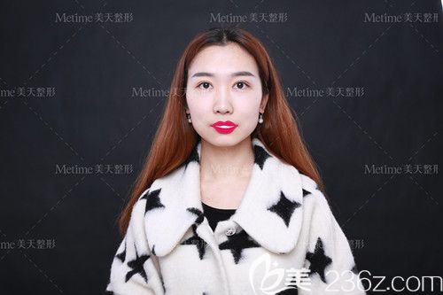 初次做雙眼皮手術(shù)就來(lái)到承德美天經(jīng)過(guò)眼綜合精雕術(shù)后效果如我預(yù)想那樣真實(shí)自然