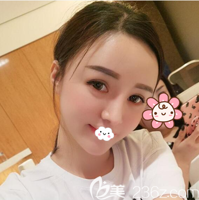 成都西區(qū)醫(yī)院脂肪填充術(shù)后一周