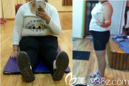 在成都西區(qū)醫(yī)院做抽脂手術(shù)前照片 在成都西區(qū)醫(yī)院做抽脂手術(shù)前照片