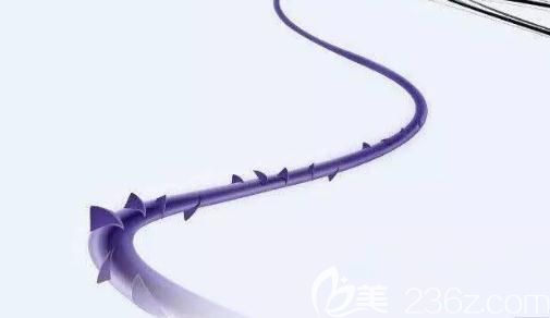 臉部提升緊致項目-埋線提升：