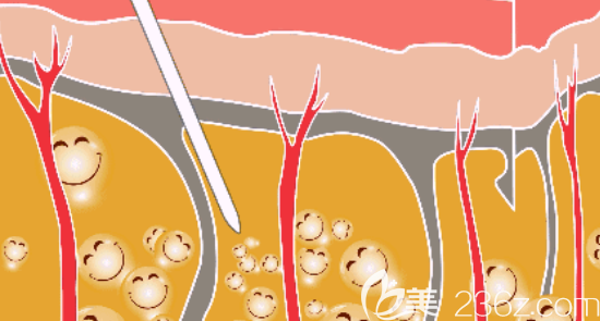 20190419_1555644556163833.png image.png