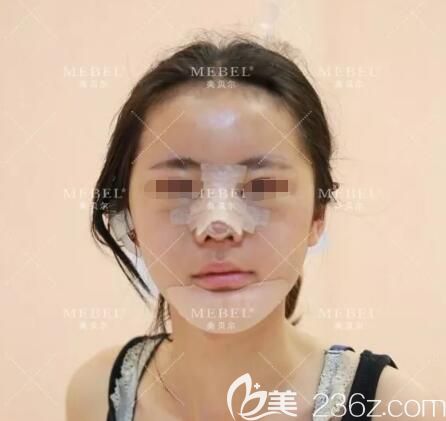 睡了一覺起來面部腫脹明顯嚴(yán)重 睡了一覺起來面部腫脹明顯嚴(yán)重