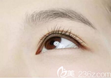 大連張建光醫(yī)生介紹哪些人不適合割雙眼皮？