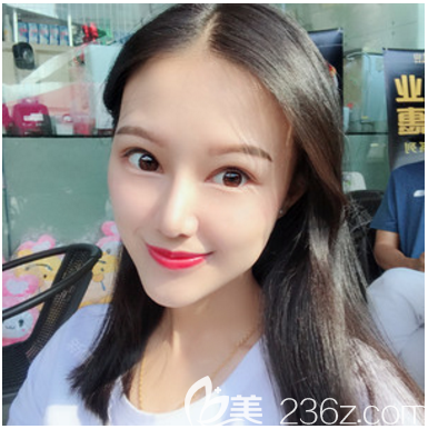 深圳米蘭柏羽朱武根做隆鼻子手術(shù)怎么樣