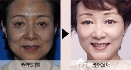 遵義利美康祛斑怎么樣 遵義利美康祛斑怎么樣