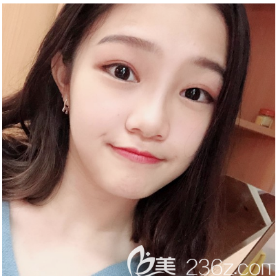 東莞哪家醫(yī)院做雙眼皮比較好？