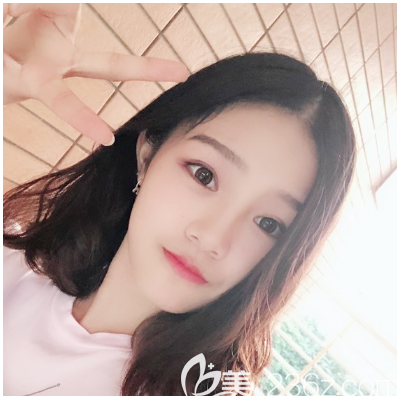 東莞哪家醫(yī)院做雙眼皮比較好？看我剛找東莞韓美王仁斌主任做的眼綜合效果怎么樣