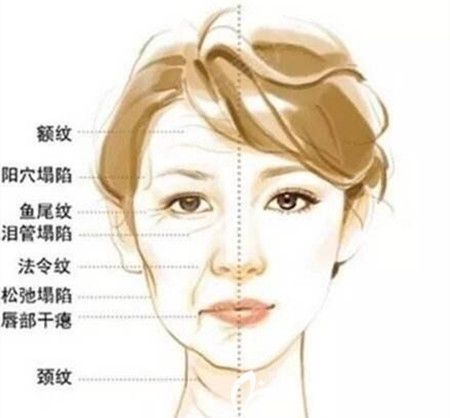 線雕的優(yōu)勢及維持時間