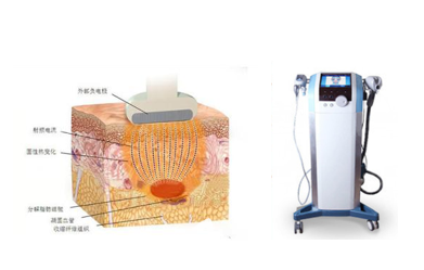 射頻溶脂瘦臉示意圖及設(shè)備展示