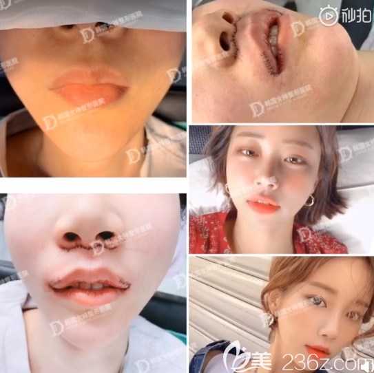 韓國女神嘴角上揚 韓國女神嘴角上揚