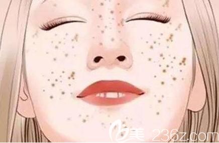 皮秒激光治療斑點(diǎn)范圍