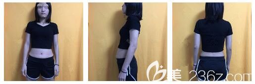 面診南通儷人連天美術(shù)前腰腹部肥胖 面診南通儷人連天美術(shù)前腰腹部肥胖