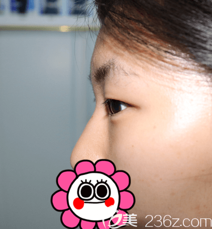 在北京壹加壹做玖度媚眼前側(cè)面照 在北京壹加壹做玖度媚眼前側(cè)面照