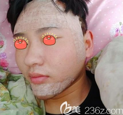 杭州薇琳醫(yī)美自體脂肪填充<span style= 杭州薇琳醫(yī)美自體脂肪填充<span style=