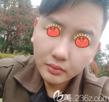 杭州薇琳整形自體脂肪填充<span style= 杭州薇琳整形自體脂肪填充<span style=