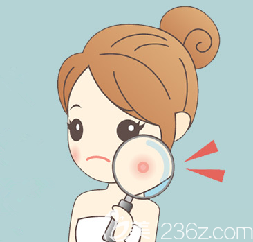 臉部長痘示意圖