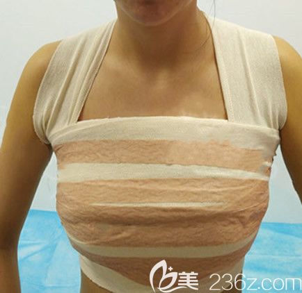 曼托假體隆胸第二天效果 曼托假體隆胸第二天效果