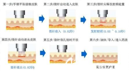 黃金微雕有什么功效呢？