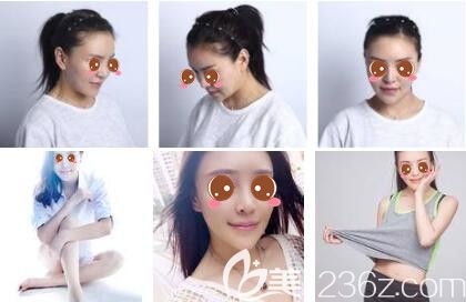 上海時(shí)光整形外科醫(yī)院李桂海發(fā)際線種植真人案例 上海時(shí)光整形外科醫(yī)院李桂海發(fā)際線種植真人案例