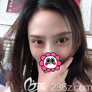 北京美萊眼綜合案例 北京美萊眼綜合案例