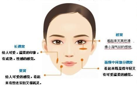 什么是酒窩成型術(shù) 什么是酒窩成型術(shù)