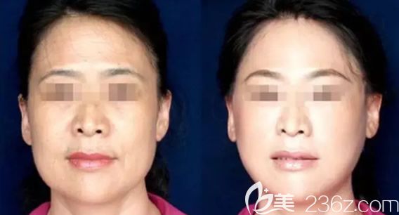 包頭葉子吉志俊做線雕怎么樣 包頭葉子吉志俊做線雕怎么樣