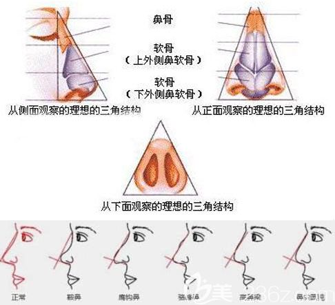 韓國Glory整形根據(jù)不同鼻型打造精致鼻尖 韓國Glory整形根據(jù)不同鼻型打造精致鼻尖
