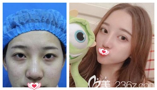 石家莊天伊美五月小長假含2980元雙眼皮的美麗大禮包來襲 請注意查收