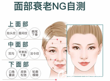 面部下垂自測(cè)圖