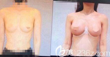 韓國md李相逹魔滴（無芯片）300、265，目前總體還算滿意