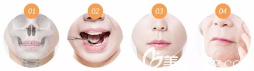 韓國MVP人中縮短術(shù) 韓國MVP人中縮短術(shù)