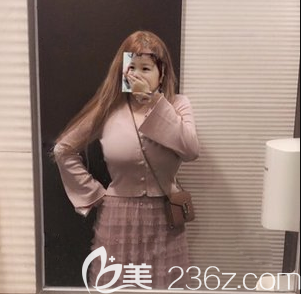 腰腹吸脂術(shù)后又做了面部吸脂+手臂吸脂 腰腹吸脂術(shù)后又做了面部吸脂+手臂吸脂