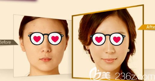 肖明明醫(yī)生注射效果好嗎 肖明明醫(yī)生注射效果好嗎